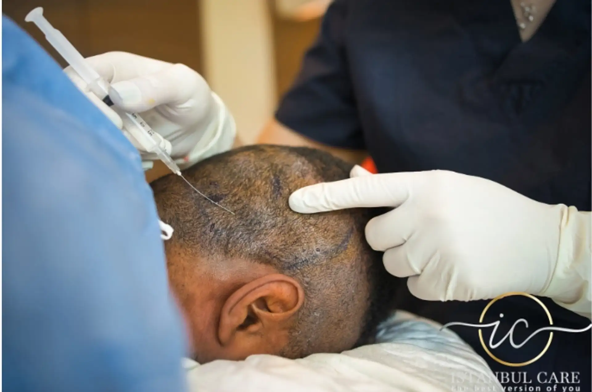 sapphire hair transplant in turkey