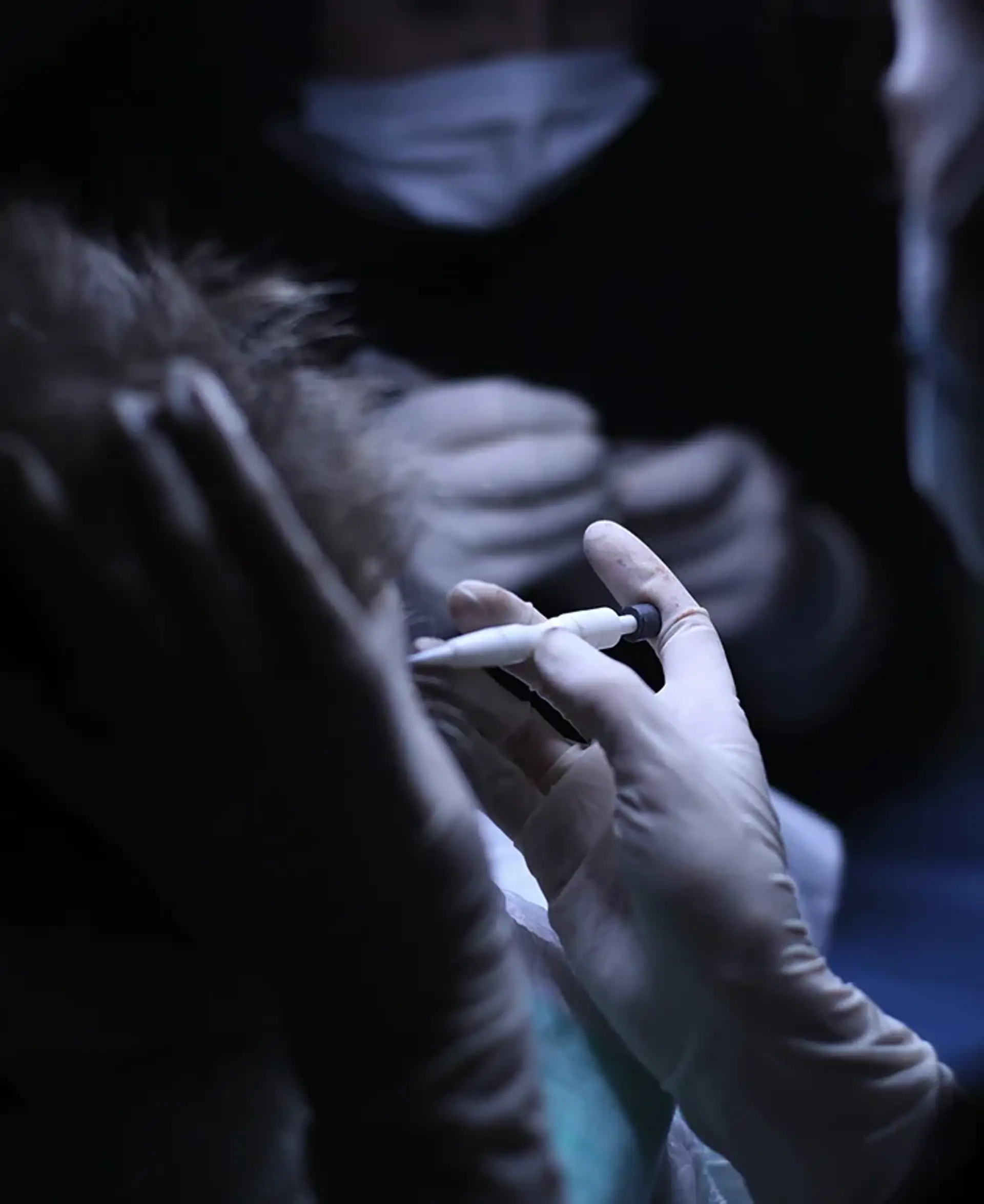 Why the no-shave option appeals to many patients