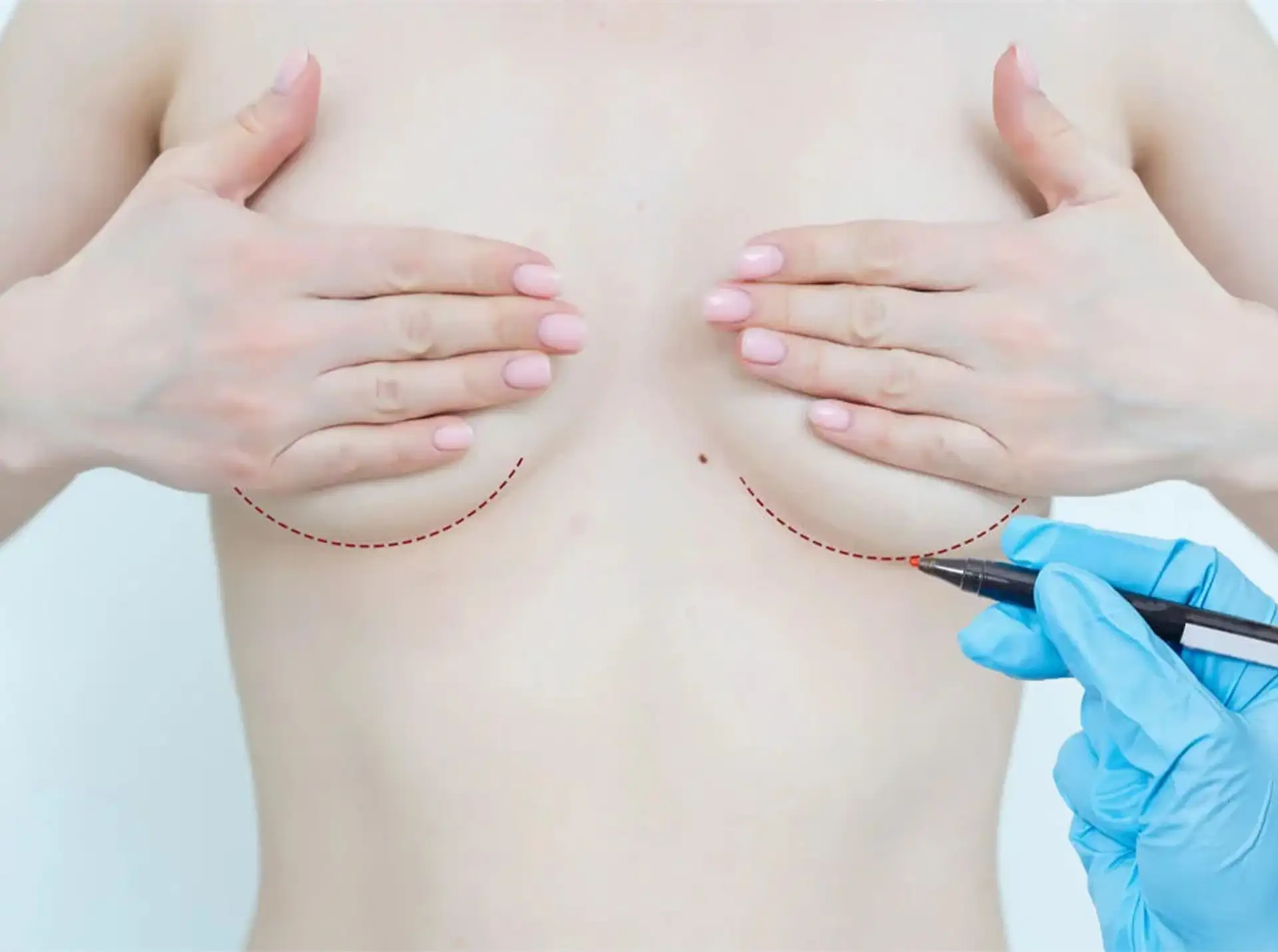 Benefits of Breast Reduction Surgery