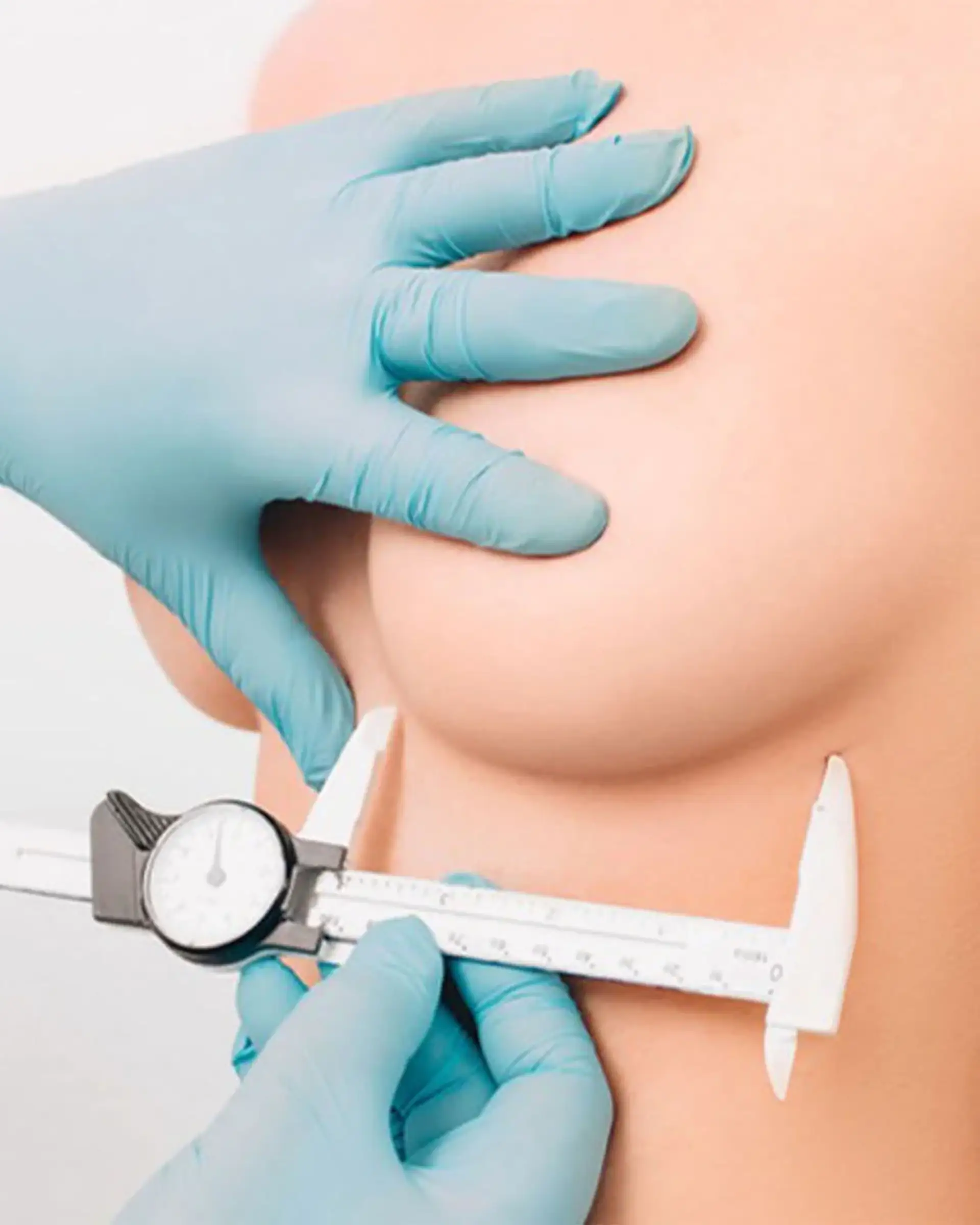 Breast Lift Surgery Risks