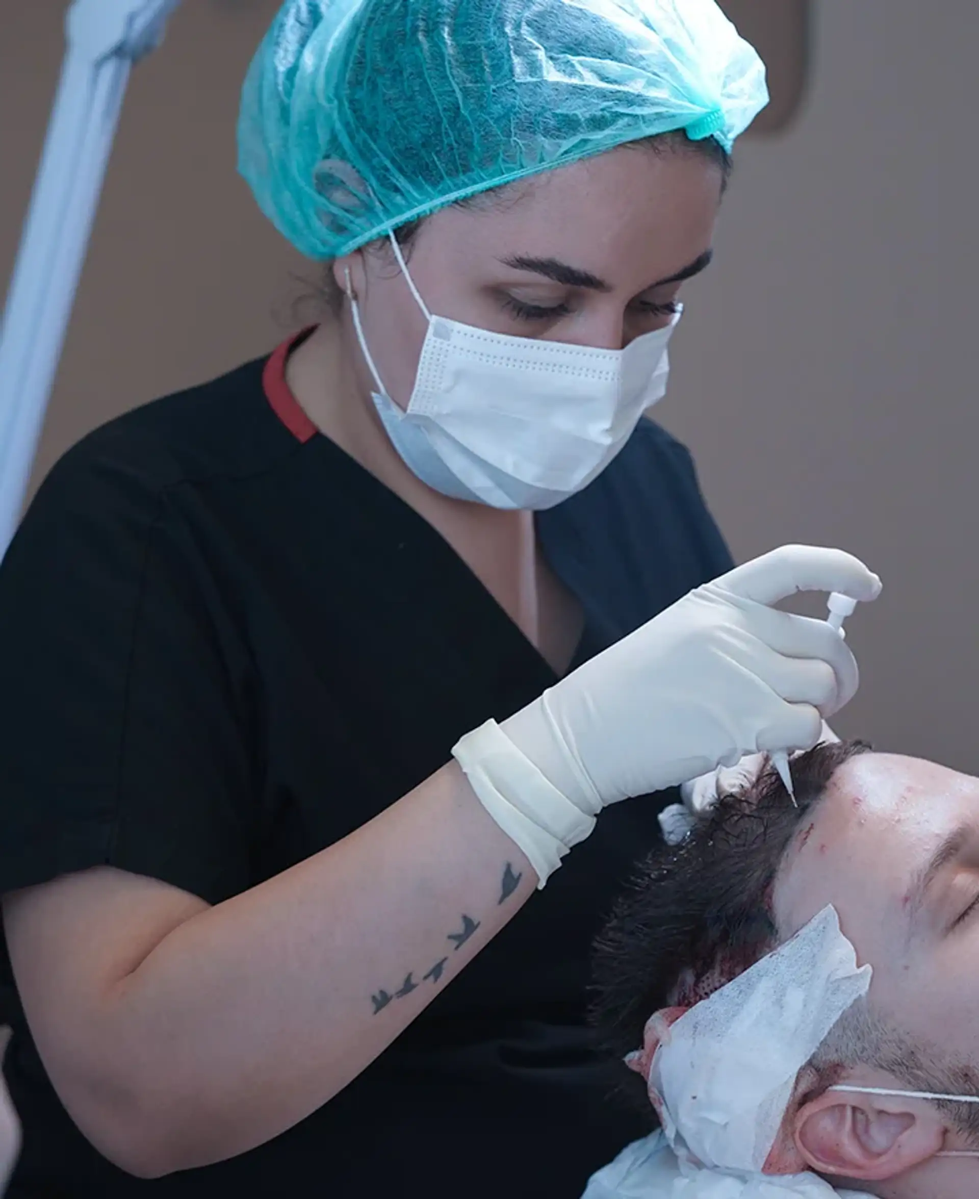 Designing the hairline and preparing the donor area