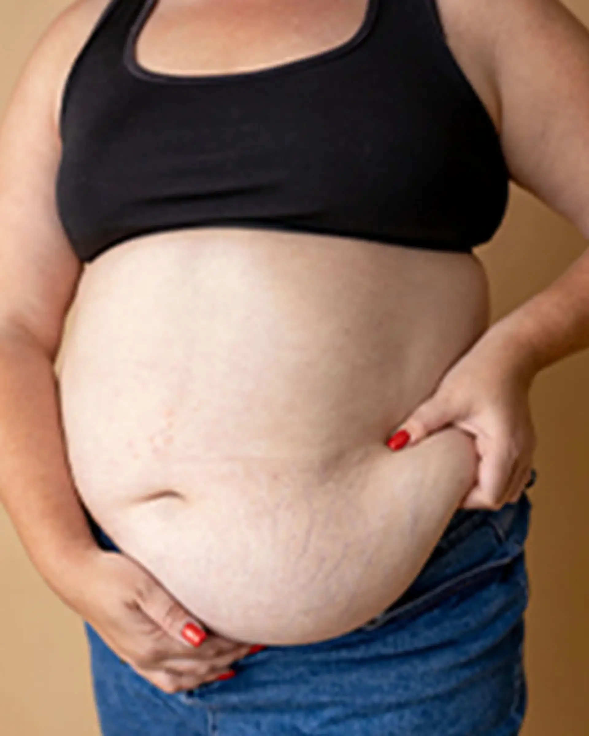 How Does Gastric Banding Help Patients Lose Weight?