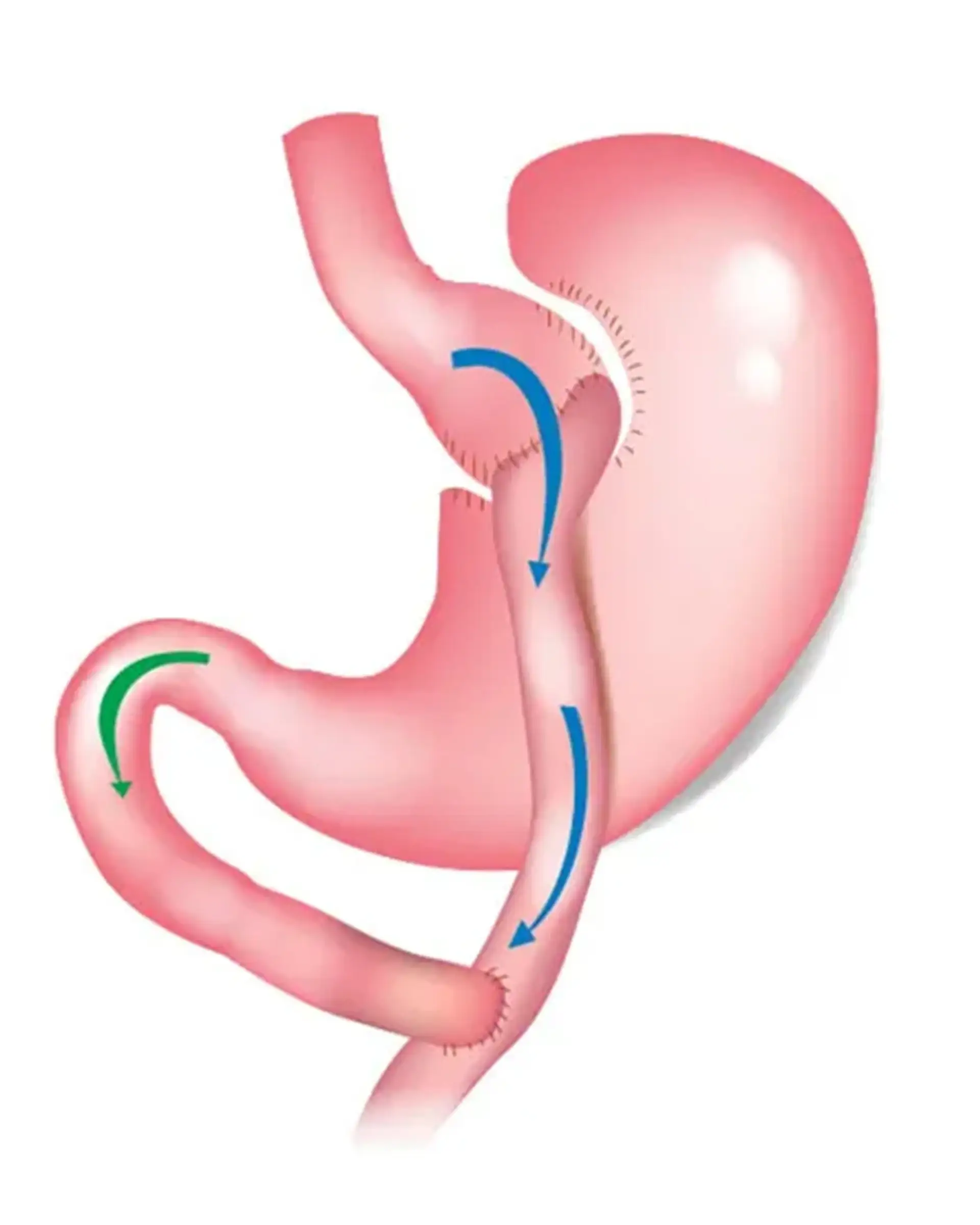How Surgery Works