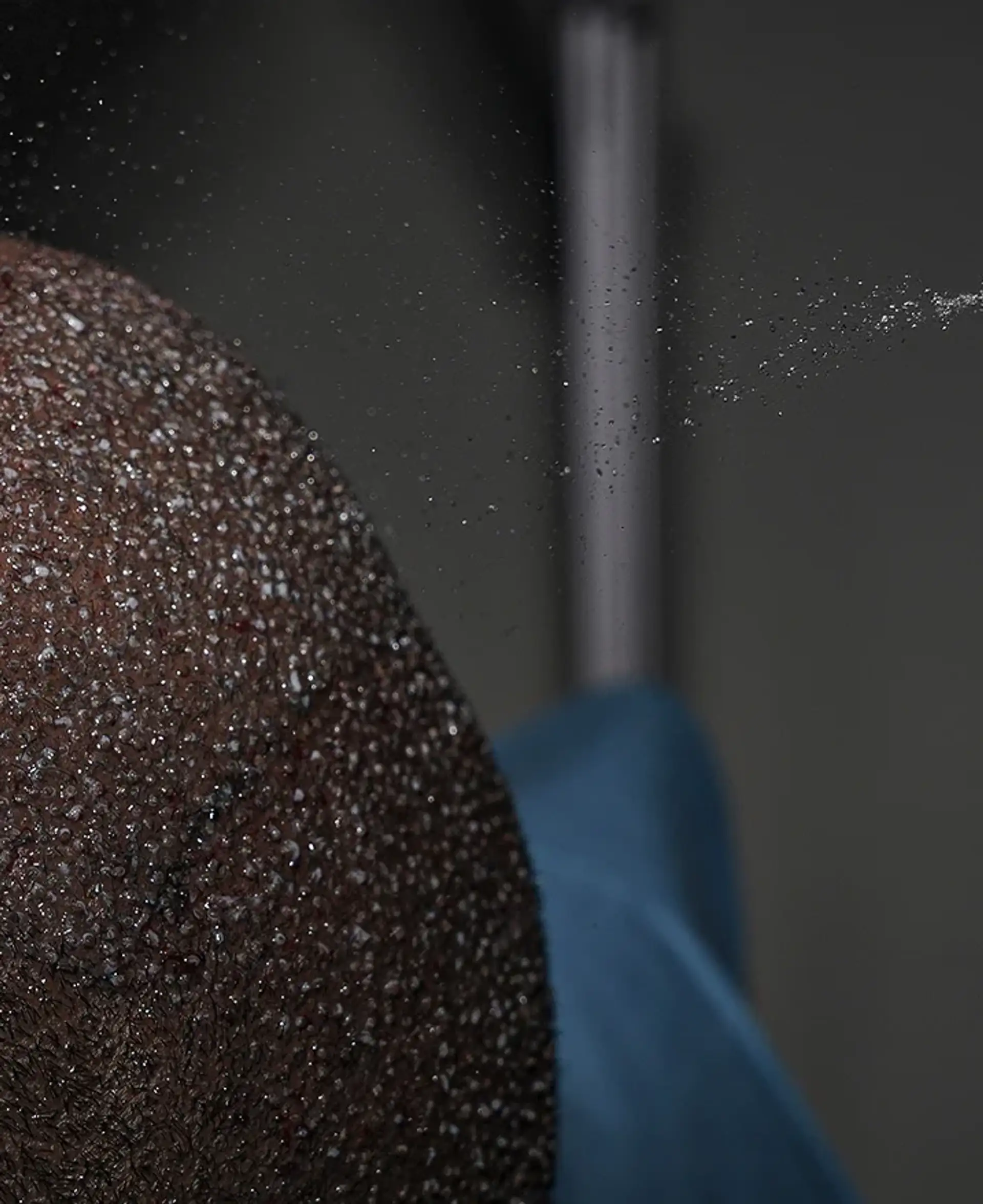 Understanding Follicular Unit Extraction and how it works