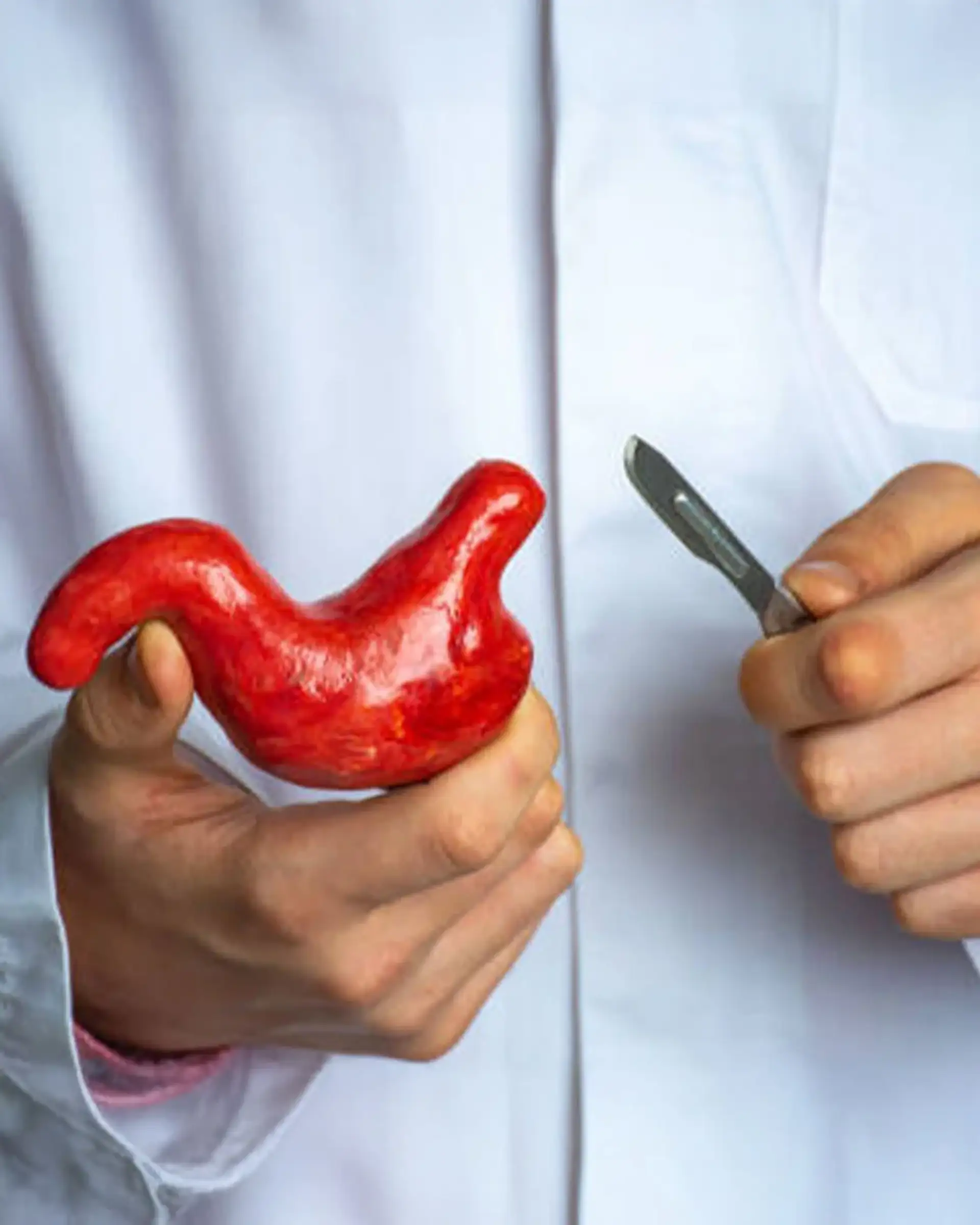 What Are the Side Effects of Gastric Bypass Surgery?