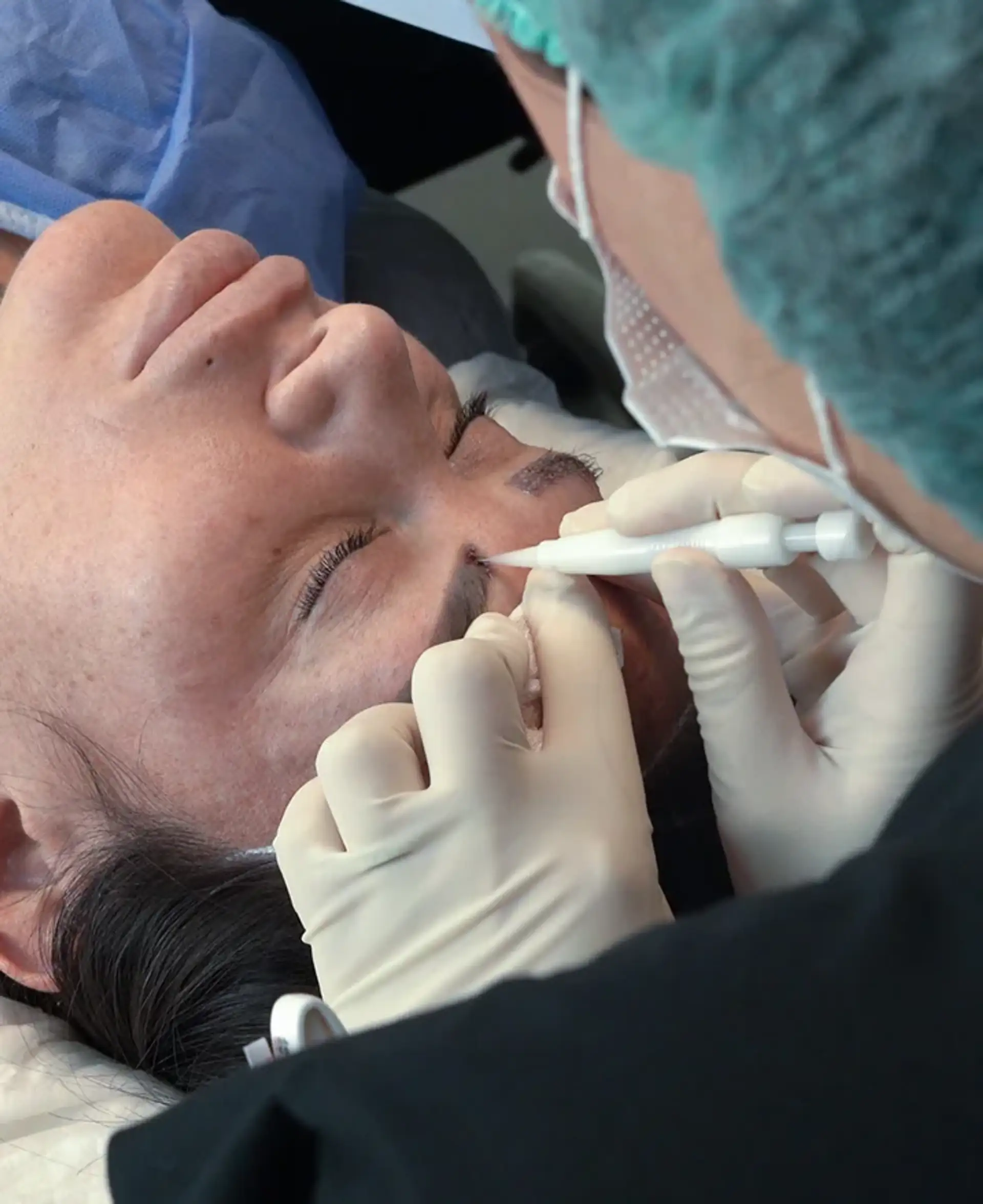 When Eyebrow Transplant Surgery is Not Recommended