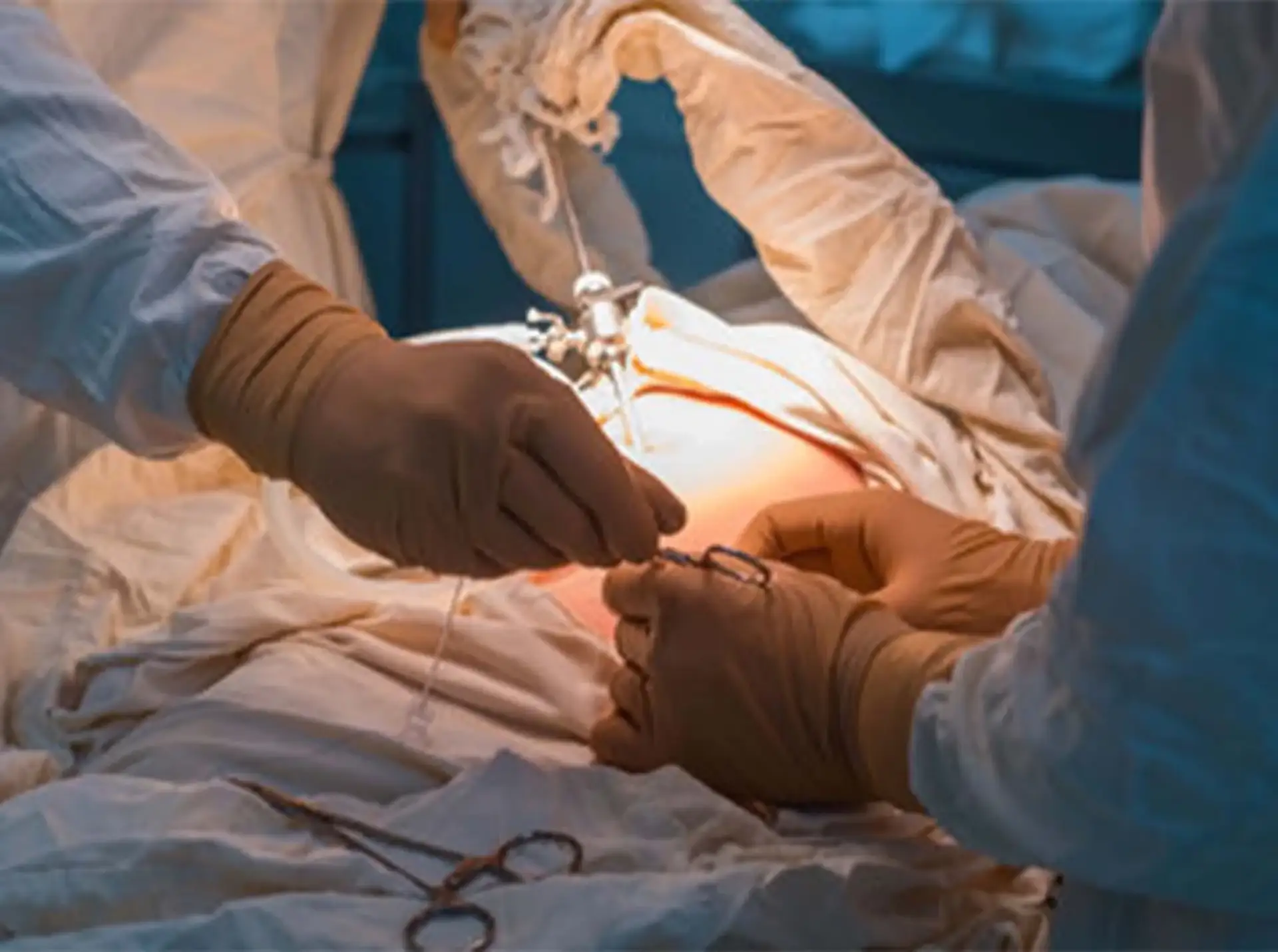 Who Can Have Gastric Bypass Surgery?