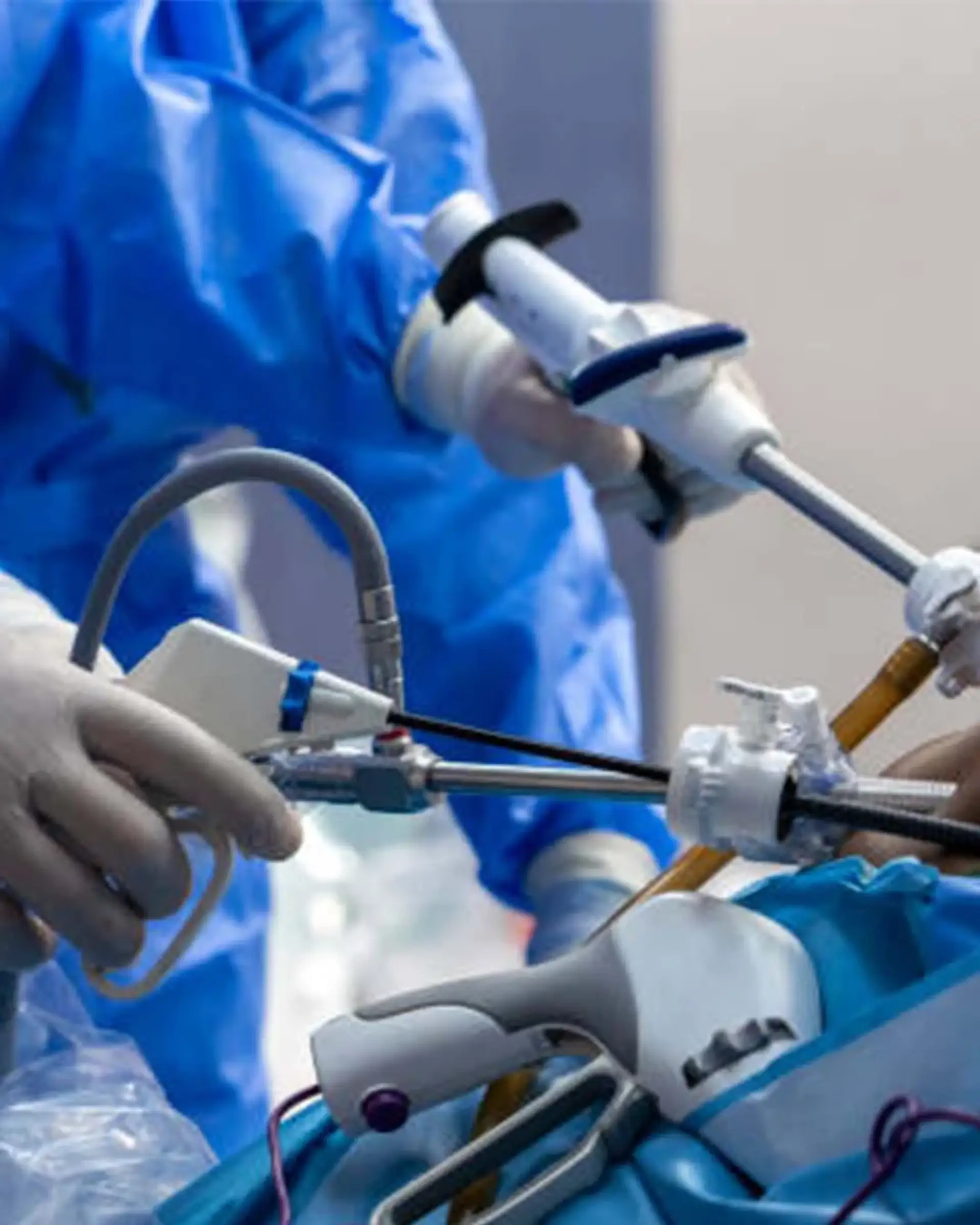 Who Qualifies for LAP-BAND Surgery?
