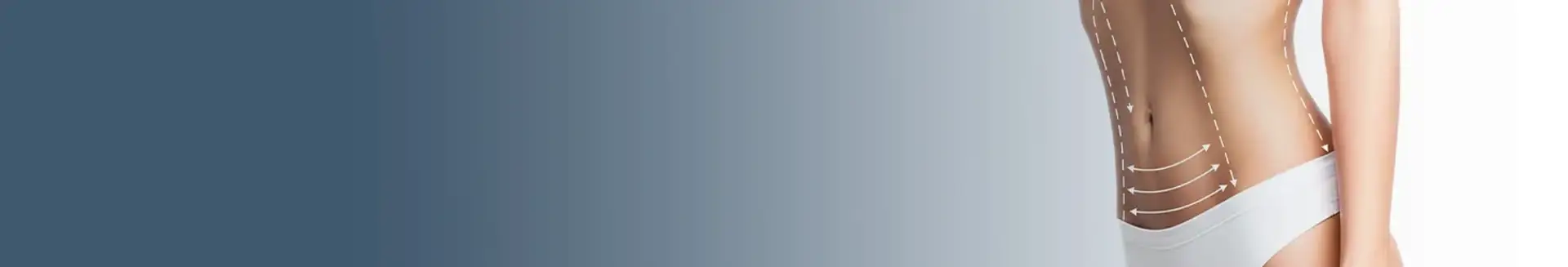 Mega Liposuction in Turkey